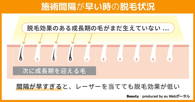 施術間隔が早い時の脱毛状況