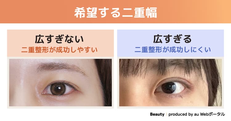 希望する二重幅の比較