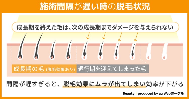 施術間隔が遅い時の脱毛状況