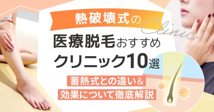 熱破壊式脱毛機の医療脱毛おすすめクリニックを解説する記事