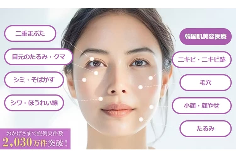 二重整形がおすすめの品川スキンクリニック
