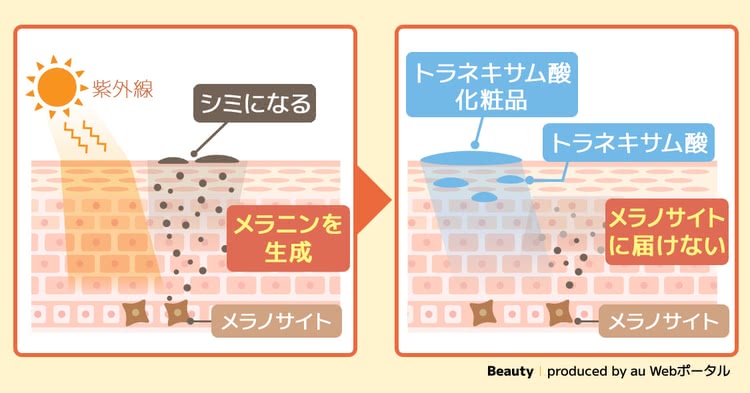 トラネキサム酸化粧品がシミを予防するメカニズム