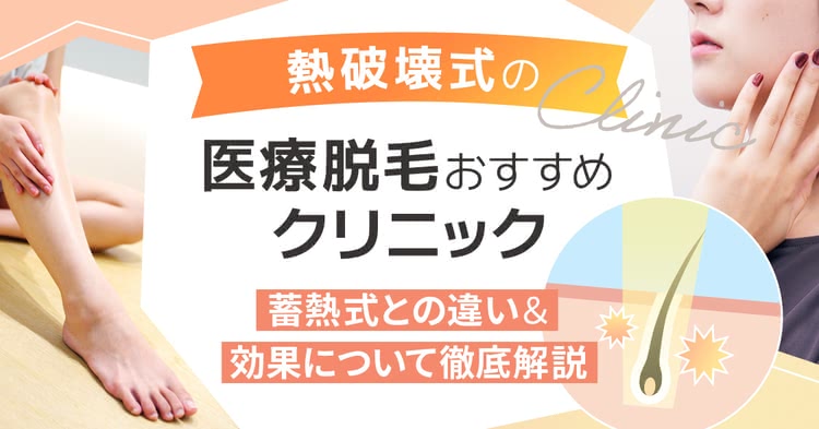 熱破壊式の医療脱毛おすすめクリニック10選｜蓄熱式より効果的？メリット＆デメリットを徹底解説