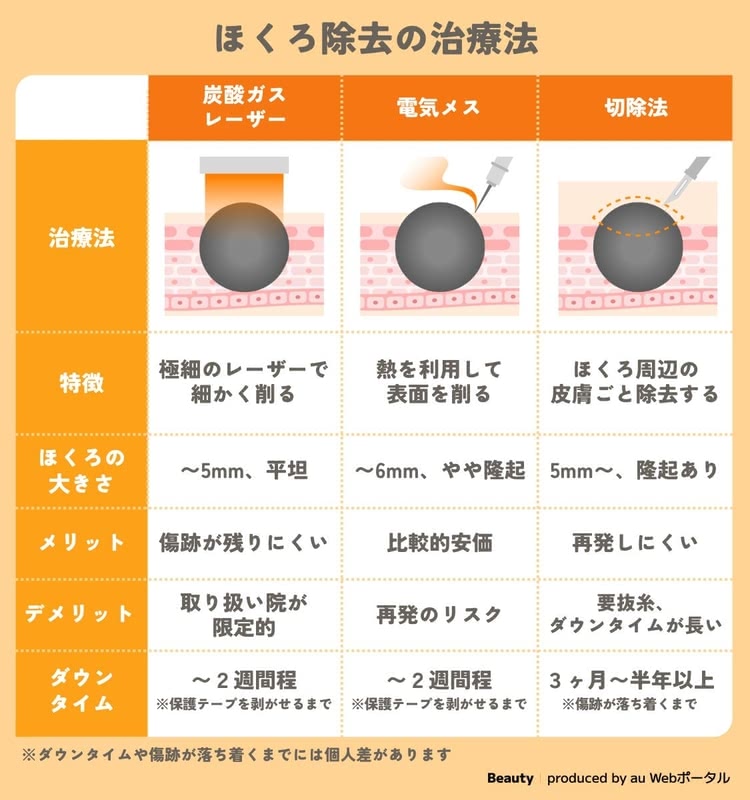 ほくろ除去の治療法3種類の比較表