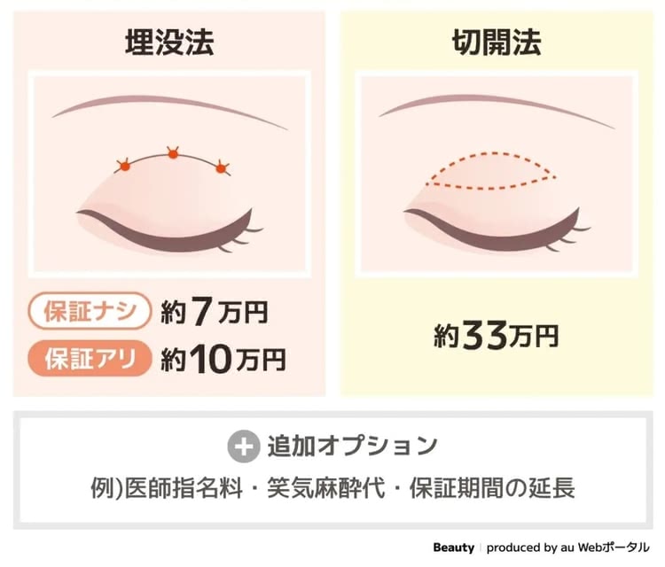 二重整形の料金相場