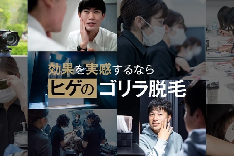 ヒゲ脱毛がおすすめのゴリラクリニック
