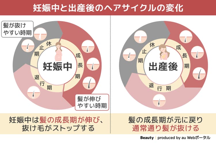 抜け毛女性の要因4,妊娠出産やホルモンバランスの乱れ