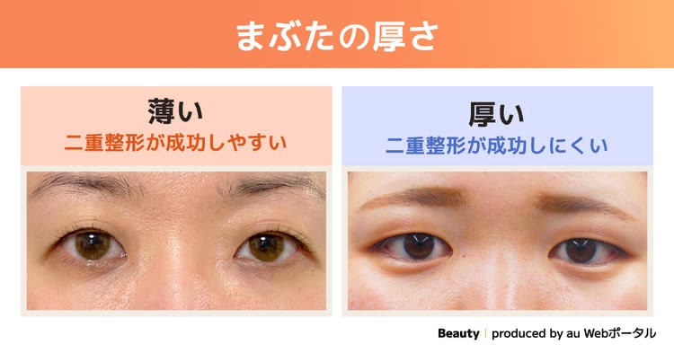 まぶたの厚さを比較する画像