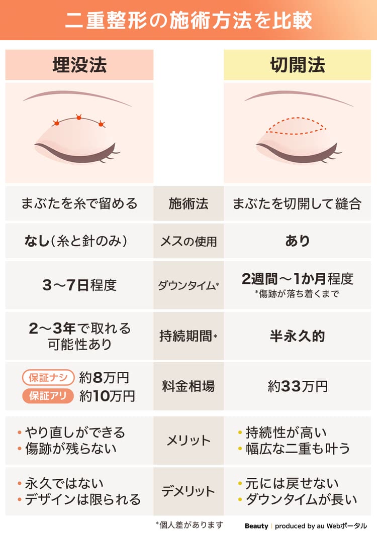 埋没法と切開法の違いを解説する比較表