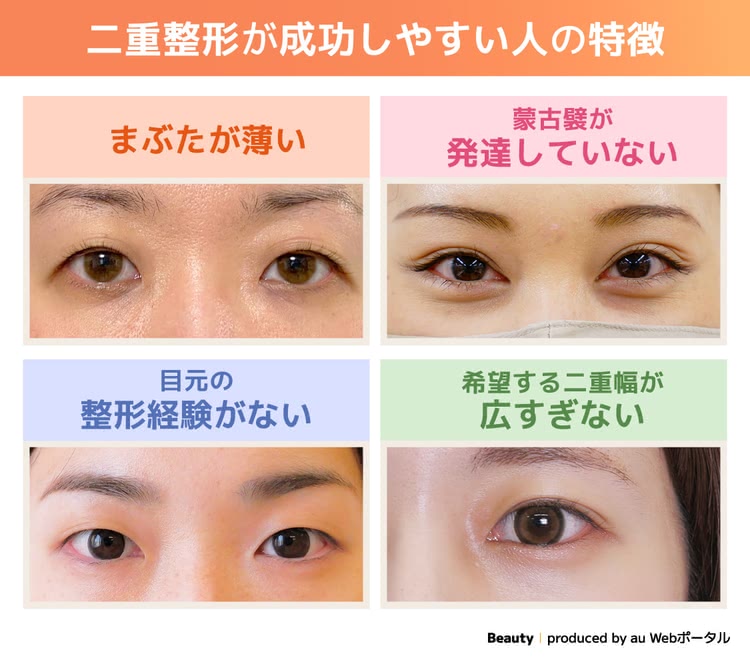 二重整形が成功しやすい人の特徴