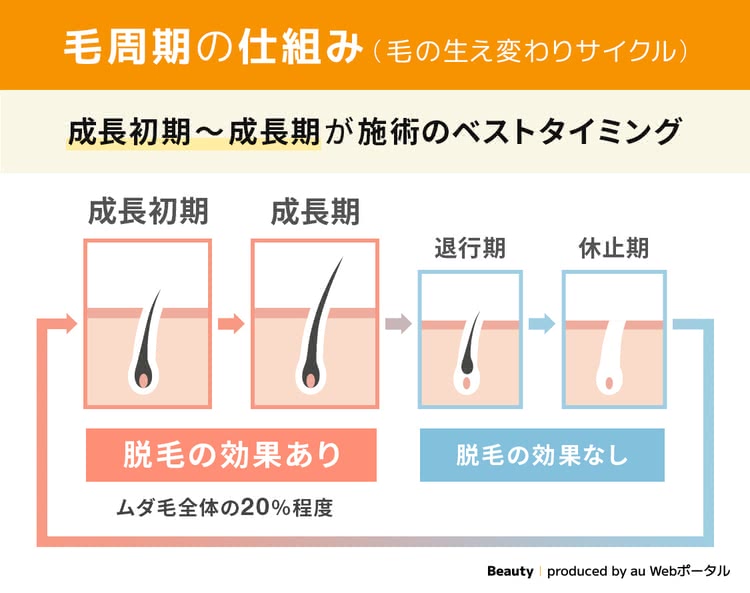 脱毛効果があるのは成長段階の毛のみ