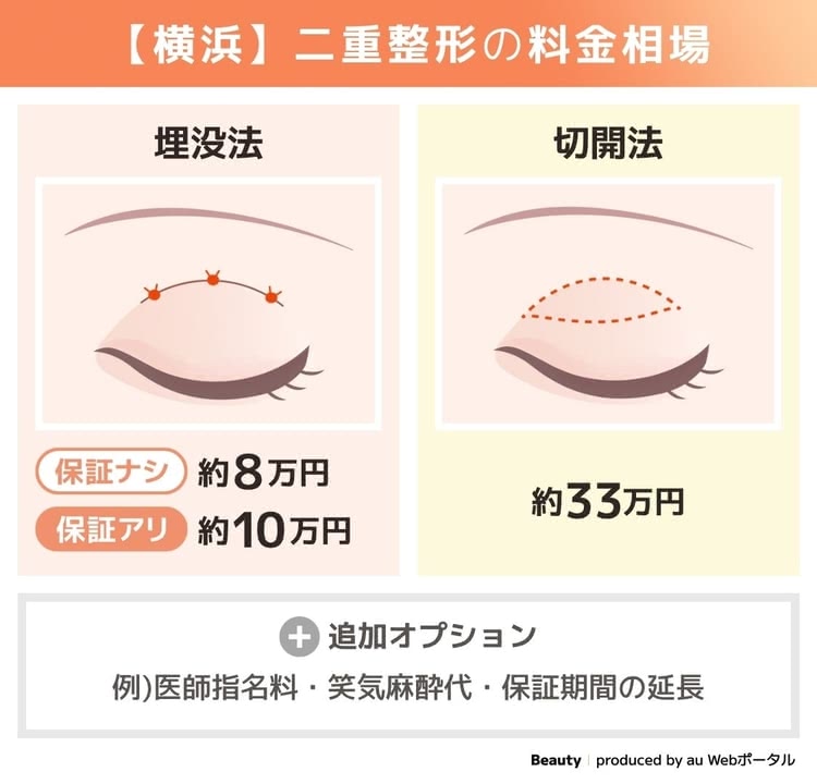 横浜の二重埋没の相場は約8万円