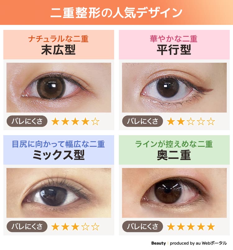 バレにくい二重整形の人気デザイン