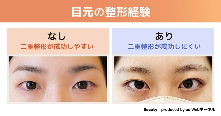 目元の整形経験有無の比較