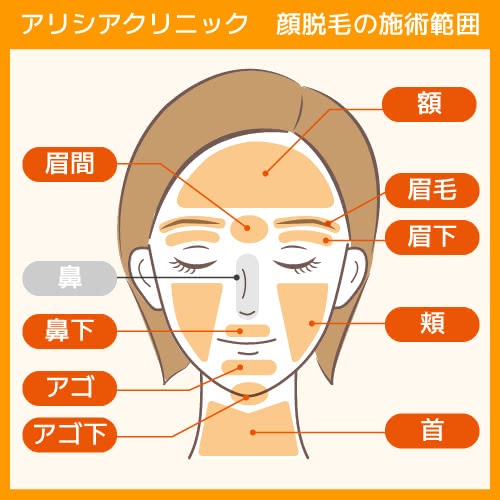 アリシアクリニックの顔脱毛の施術範囲