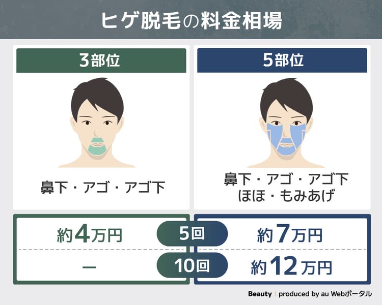 ヒゲ脱毛の料金相場を解説する図