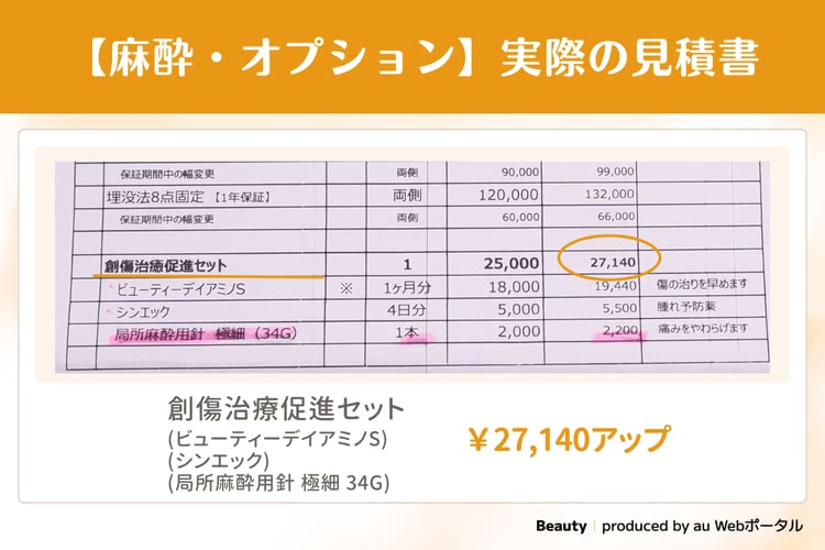麻酔・オプションの実際の見積書