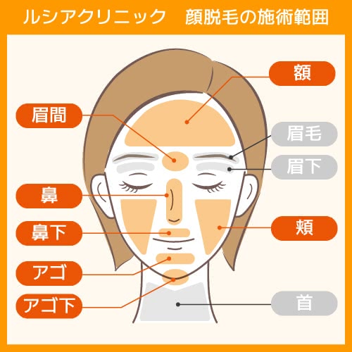 ルシアクリニックの顔脱毛の施術範囲