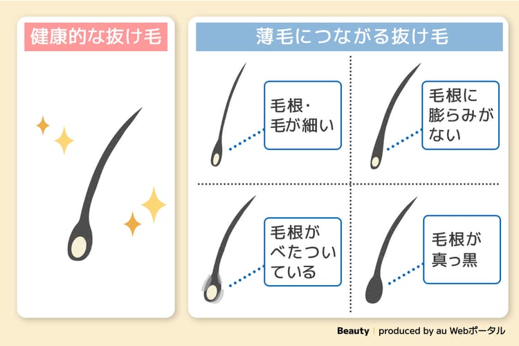 女性の抜け毛のセルフチェック方法