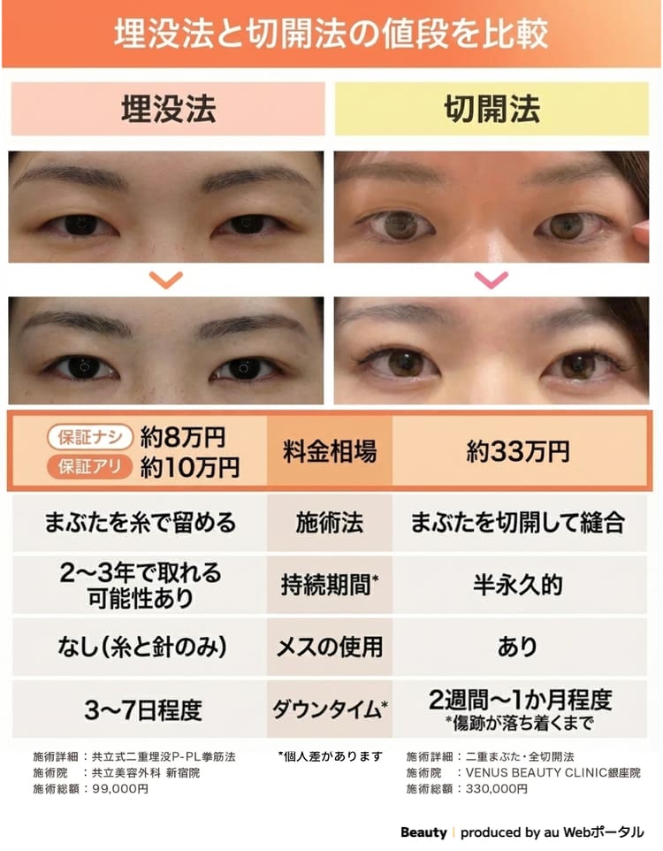 埋没と切開の値段と特徴を比較した画像