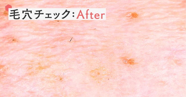 ルナソルの毛穴チェック 洗顔後は毛穴汚れは少し取れて潤う肌に