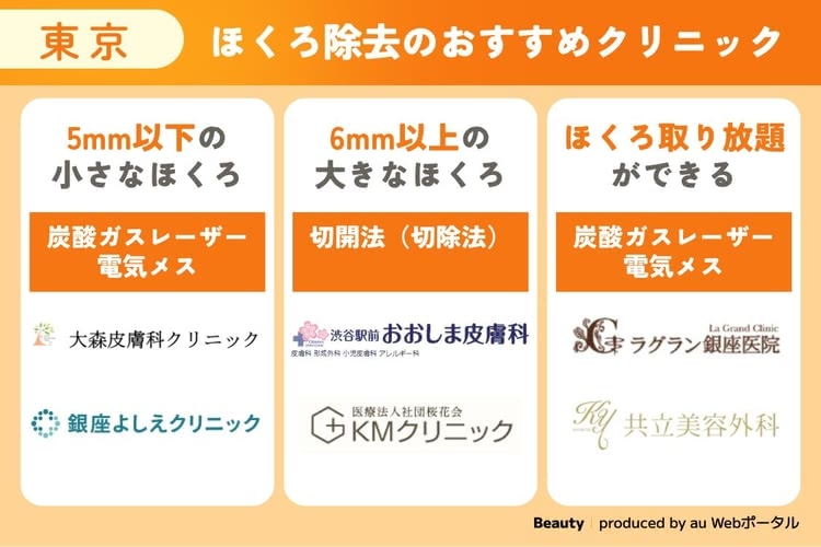 東京でほくろ除去ができるおすすめクリニック早見表