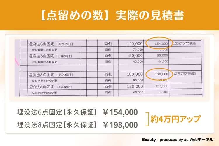 点留め数によって変わる実際の見積書