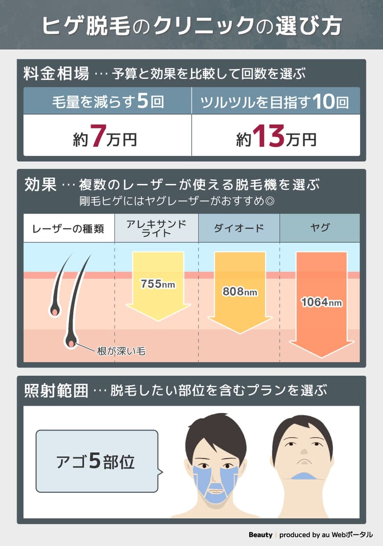 ヒゲ脱毛ができるクリニックの選び方の解説図