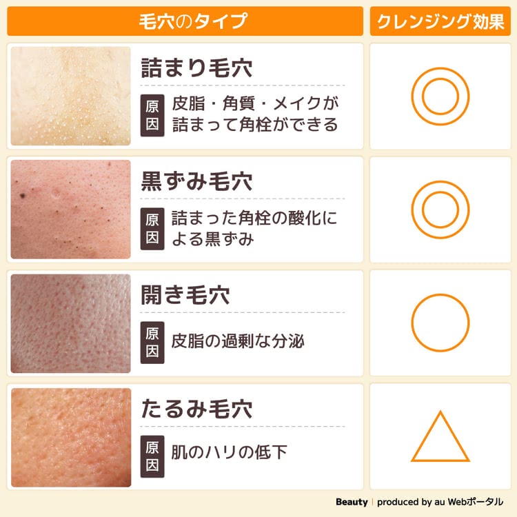 ・詰まり毛穴 原因：皮脂・角質・メイクが詰まって角栓ができる クレンジングによるケア：◎ ・黒ずみ毛穴 原因：詰まった角栓の酸化による黒ずみ クレンジングによるケア：◎ ・開き毛穴 原因：皮脂の過剰な分泌 クレンジングによるケア：○ ・たるみ毛穴 原因：肌のハリの低下 クレンジングによるケア：△