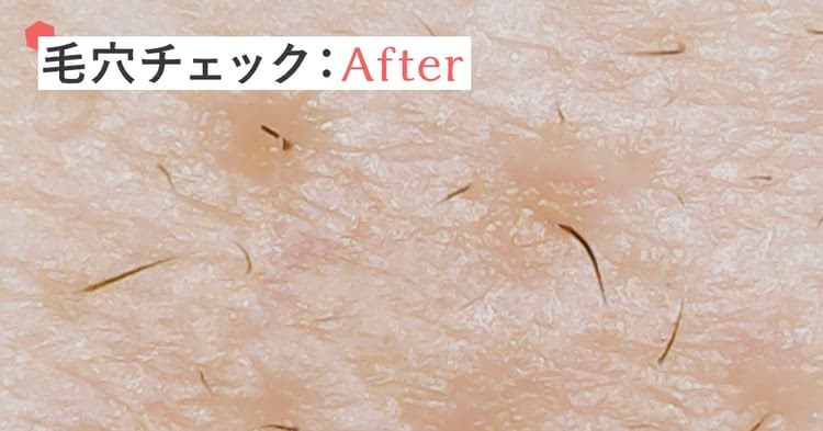 米肌の毛穴チェック 洗顔後は毛穴汚れは少し取れて潤う肌に